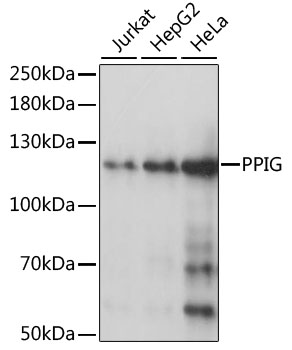 Western blot analysis of extracts of various cell lines using PPIG Polyclonal Antibody at 1:1000 dilution.