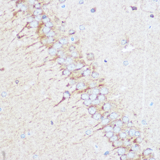 Immunohistochemistry of paraffin-embedded rat brain using TSC2 Polyclonal Antibody at dilution of 1:100 (40x lens).Perform microwave antigen retrieval with 10 mM Tris/EDTA buffer pH 9.0 before commencing with IHC staining protocol.