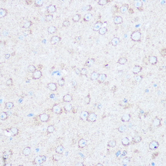 Immunohistochemistry of paraffin-embedded mouse brain using TSC2 Polyclonal Antibody at dilution of 1:100 (40x lens).Perform microwave antigen retrieval with 10 mM Tris/EDTA buffer pH 9.0 before commencing with IHC staining protocol.