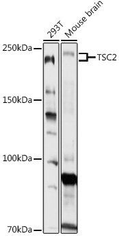 Western blot analysis of extracts of various cell lines using TSC2 Polyclonal Antibody at 1:1000 dilution.