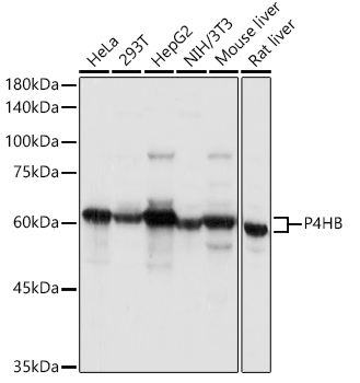 Western blot analysis of extracts of various cell lines using P4HB Polyclonal Antibody at 1:1000 dilution.