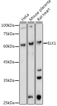 Western blot analysis of extracts of various cell lines using ELK1 Polyclonal Antibody at 1:1000 dilution.