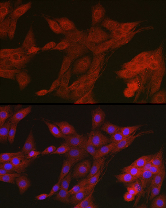 Immunofluorescence analysis of PC-12 cells using AMPKα2 Polyclonal Antibody at dilution of 1:100 (40x lens). Blue: DAPI for nuclear staining.