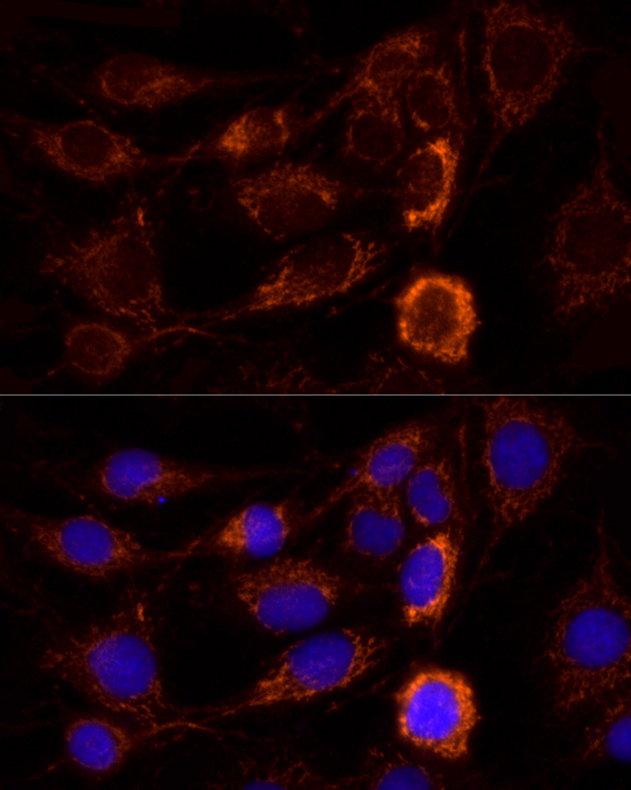 Immunofluorescence analysis of C6 cells using AIF Polyclonal Antibody at dilution of 1:100 (40x lens). Blue: DAPI for nuclear staining.