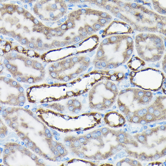 Immunohistochemistry of paraffin-embedded rat kidney using [KO Validated] AIF Polyclonal Antibody at dilution of 1:50 (40x lens).Perform high pressure antigen retrieval with 10 mM citrate buffer pH 6.0 before commencing with IHC staining protocol.