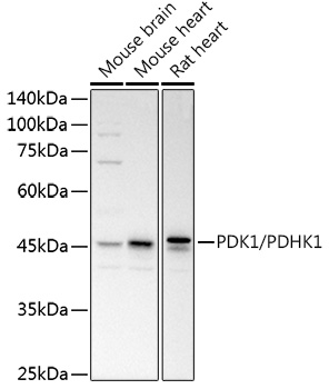 Western blot analysis of extracts of various cell lines using PDK1/PDHK1 Polyclonal Antibody at 1:1000 dilution.