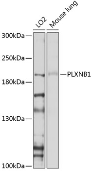 Western blot analysis of extracts of various cell lines using PLXNB1 Polyclonal Antibody at 1:1000 dilution.