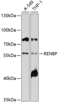 Western blot analysis of extracts of various cell lines using RENBP Polyclonal Antibody at 1:1000 dilution.