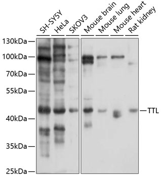 Western blot analysis of extracts of various cell lines using TTL Polyclonal Antibody at 1:1000 dilution.