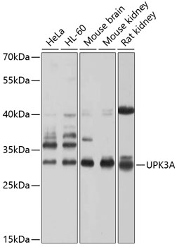 Western blot analysis of extracts of various cell lines using UPK3A Polyclonal Antibody at 1:1000 dilution.