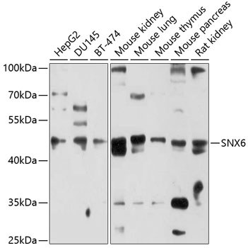 Western blot analysis of extracts of various cell lines using SNX6 Polyclonal Antibody at 1:1000 dilution.