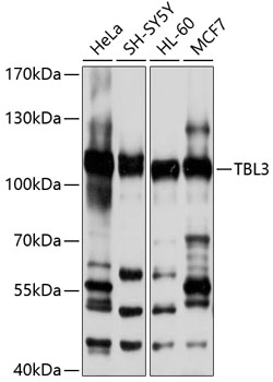 Western blot analysis of extracts of various cell lines using TBL3 Polyclonal Antibody at 1:1000 dilution.