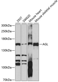 Western blot analysis of extracts of various cell lines using AGL Polyclonal Antibody at 1:1000 dilution.