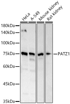 Western blot analysis of various lysates using PATZ1 Polyclonal Antibody at 1:2000 dilution.