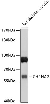 Western blot analysis of extracts of rat skeletal muscle using CHRNA2 Polyclonal Antibody at 1:1000 dilution.