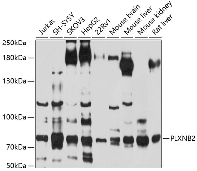 Western blot analysis of extracts of various cell lines using PLXNB2 Polyclonal Antibody at 1:1000 dilution.