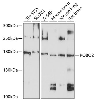 Western blot analysis of extracts of various cell lines using ROBO2 Polyclonal Antibody at 1:1000 dilution.