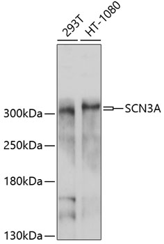 Western blot analysis of extracts of various cell lines using SCN3A Polyclonal Antibody at 1:1000 dilution.