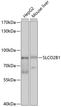 Western blot analysis of extracts of various cell lines using SLCO2B1 Polyclonal Antibody at 1:1000 dilution.