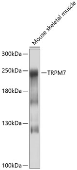 Western blot analysis of extracts of mouse skeletal muscle using TRPM7 Polyclonal Antibody at 1:1000 dilution.