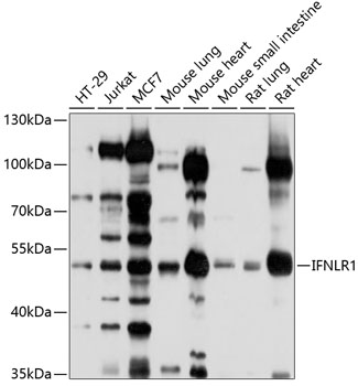 Western blot analysis of extracts of various cell lines using IFNLR1 Polyclonal Antibody at 1:1000 dilution.