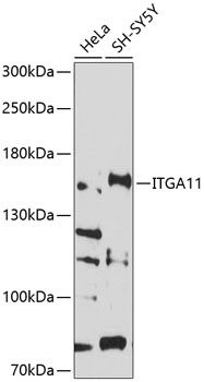 Western blot analysis of extracts of various cell lines using ITGA11 Polyclonal Antibody at 1:1000 dilution.