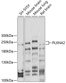 Western blot analysis of extracts of various cell lines using PLXNA2 Polyclonal Antibody at 1:1000 dilution.