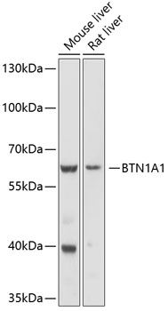 Western blot analysis of extracts of various cell lines using BTN1A1 Polyclonal Antibody at 1:1000 dilution.