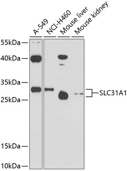 Western blot analysis of extracts of various cell lines using SLC31A1 Polyclonal Antibody at 1:1000 dilution.