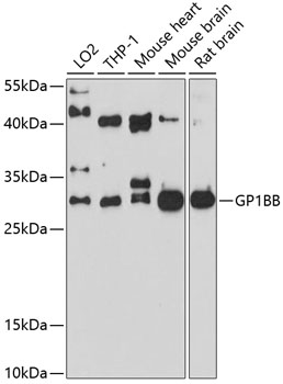 Western blot analysis of extracts of various cell lines using GP1BB Polyclonal Antibody at 1:1000 dilution.