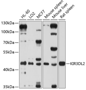 Western blot analysis of extracts of various cell lines using KIR3DL2 Polyclonal Antibody at 1:1000 dilution.