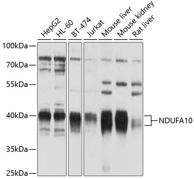 Western blot analysis of extracts of various cell lines using NDUFA10 Polyclonal Antibody at 1:1000 dilution.