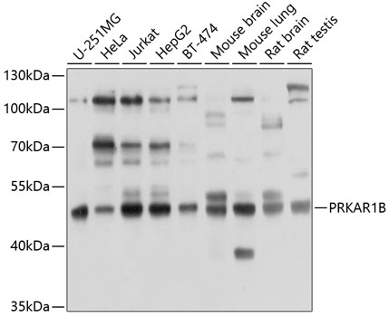 Western blot analysis of extracts of various cell lines using PRKAR1B Polyclonal Antibody at 1:1000 dilution.