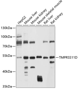 Western blot analysis of extracts of various cell lines using TMPRSS11D Polyclonal Antibody at 1:1000 dilution.