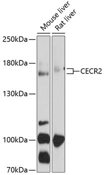 Western blot analysis of extracts of various cell lines using CECR2 Polyclonal Antibody at 1:1000 dilution.