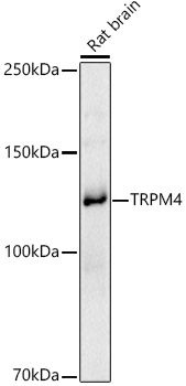 Western blot analysis of extracts of Rat brain using TRPM4 Polyclonal Antibody at 1:1000 dilution.