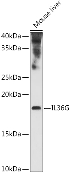 Western blot analysis of extracts of various cell lines using IL36G Polyclonal Antibody at 1:1000 dilution.