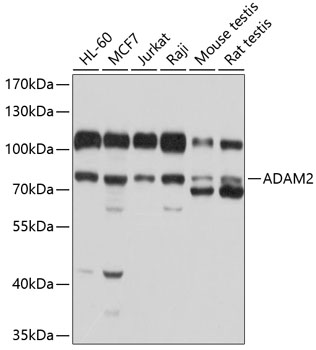 Western blot analysis of extracts of various cell lines using ADAM2 Polyclonal Antibody at 1:1000 dilution.