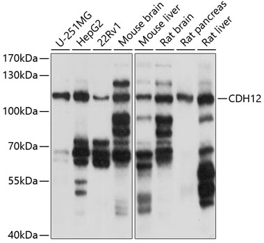 Western blot analysis of extracts of various cell lines using CDH12 Polyclonal Antibody at 1:1000 dilution.