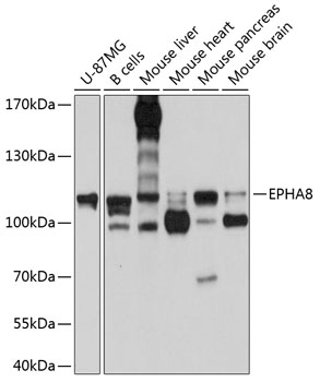 Western blot analysis of extracts of various cell lines using EPHA8 Polyclonal Antibody at 1:1000 dilution.