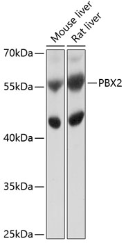 Western blot analysis of extracts of various cell lines using PBX2 Polyclonal Antibody at 1:1000 dilution.