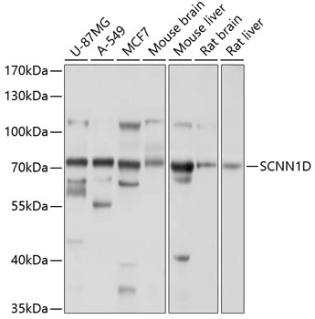 Western blot analysis of extracts of various cell lines using SCNN1D Polyclonal Antibody at 1:1000 dilution.