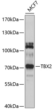 Western blot analysis of extracts of MCF-7 cells using TBX2 Polyclonal Antibody at 1:1000 dilution.