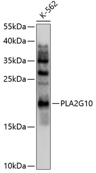 Western blot analysis of extracts of K562 cells using PLA2G10 Polyclonal Antibody at 1:1000 dilution.