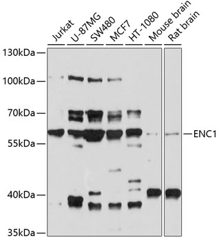 Western blot analysis of extracts of various cell lines using ENC1 Polyclonal Antibody at 1:1000 dilution.