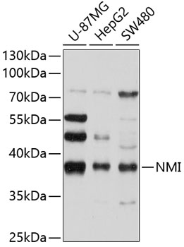 Western blot analysis of extracts of various cell lines using NMI Polyclonal Antibody at 1:1000 dilution.