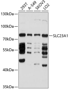 Western blot analysis of extracts of various cell lines using SLC23A1 Polyclonal Antibody at 1:1000 dilution.