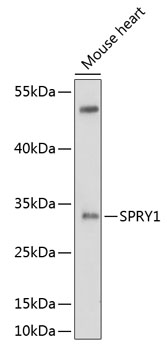 Western blot analysis of extracts of mouse heart using SPRY1 Polyclonal Antibody at 1:1000 dilution.