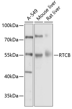 Western blot analysis of extracts of various cell lines using RTCB Polyclonal Antibody at 1:1000 dilution.