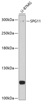 Western blot analysis of extracts of U-87MG cells using SPG11 Polyclonal Antibody at 1:1000 dilution.